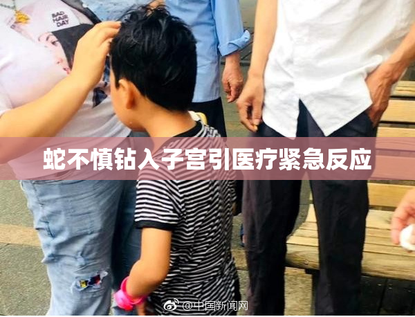 蛇不慎钻入子宫引医疗紧急反应