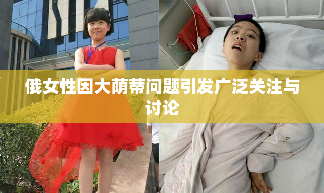 俄女性因大荫蒂问题引发广泛关注与讨论