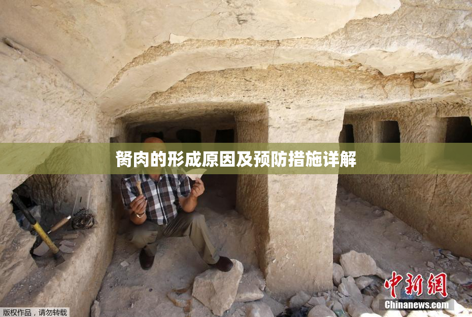 胬肉的形成原因及预防措施详解