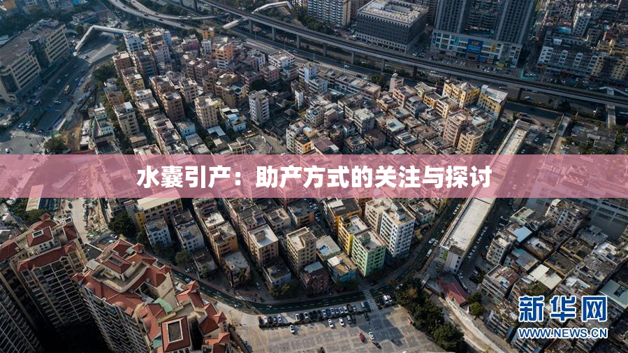 水囊引产：助产方式的关注与探讨