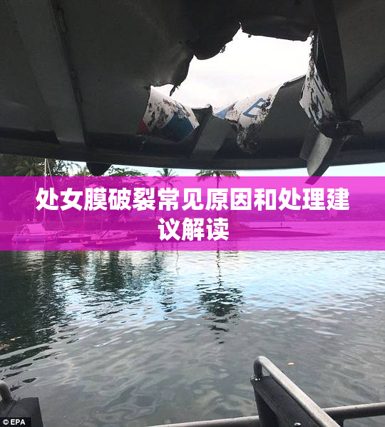 处女膜破裂常见原因和处理建议解读