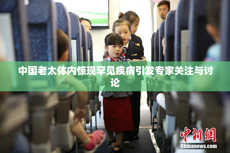 中国老太体内惊现罕见疾病引发专家关注与讨论