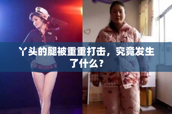 丫头的腿被重重打击，究竟发生了什么？