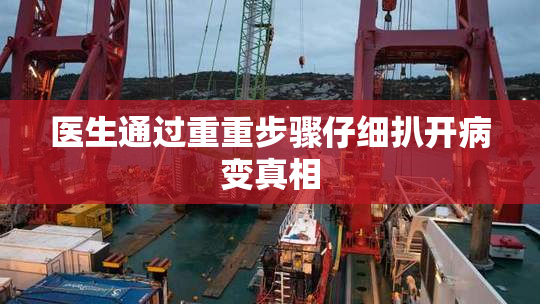 医生通过重重步骤仔细扒开病变真相
