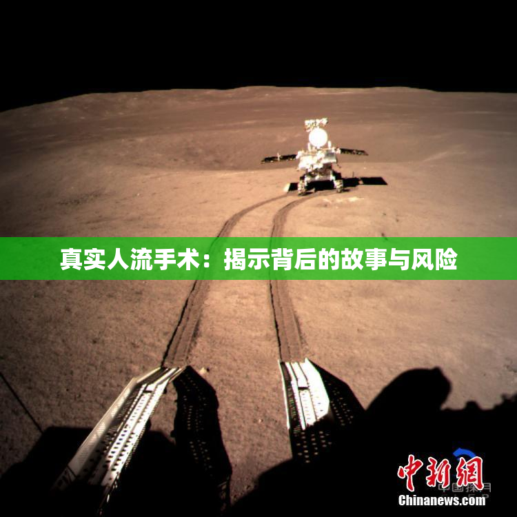 真实人流手术：揭示背后的故事与风险