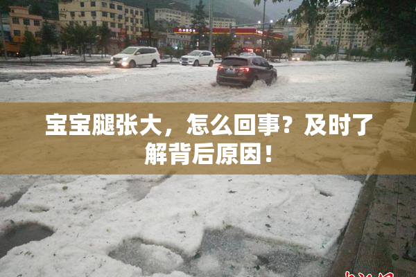 宝宝腿张大，怎么回事？及时了解背后原因！