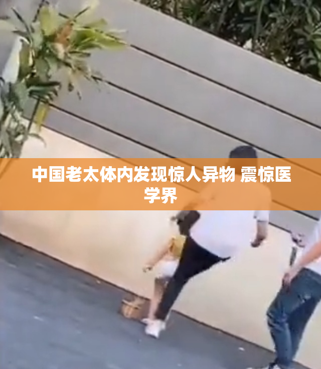 中国老太体内发现惊人异物 震惊医学界
