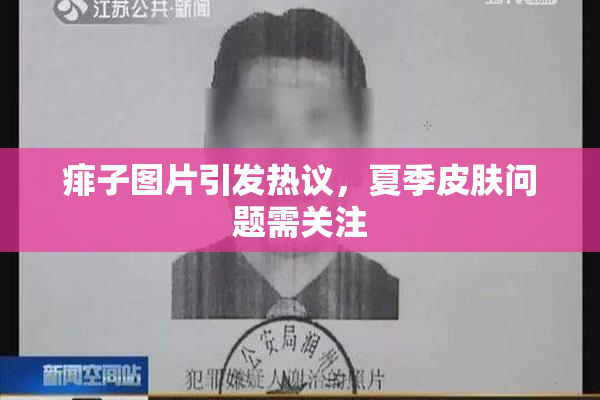 痱子图片引发热议，夏季皮肤问题需关注