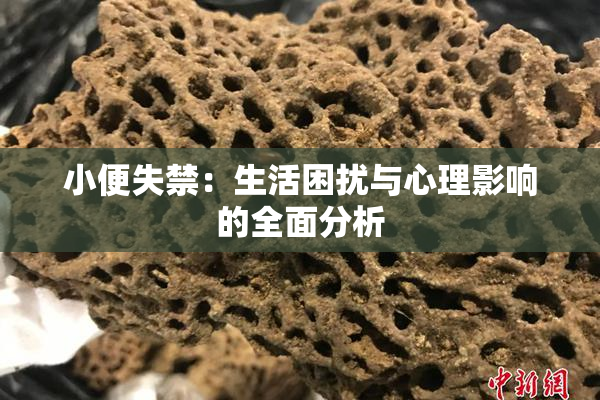 小便失禁：生活困扰与心理影响的全面分析